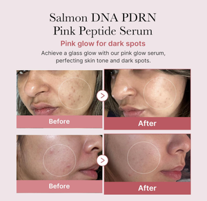 Suero de ADN de salmón, ácido hialurónico, vitamina C, rosa, PDRN, péptido rosa, niacinamida, humectante antienvejecimiento, corrección de manchas oscuras - Product Image 2