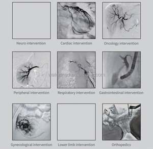 Sistema DE RAYOS X de angiografía de Sustracción <span class=keywords><strong>Digital</strong></span> médica montada en el suelo de gama alta - Product Image 6