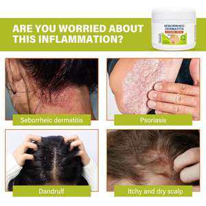 Marque privée, crème naturelle apaisante contre la dermatite séborrhéique pour le psoriasis, la folliculite, l'eczéma, le <span class=keywords><strong>cuir</strong></span> <span class=keywords><strong>chevelu</strong></span> sec et les pellicules - Product Image 5
