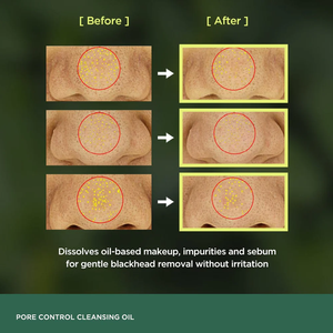 OEM <span class=keywords><strong>Limpiador</strong></span> <span class=keywords><strong>facial</strong></span> para pieles sensibles Maquillaje Eliminación Hidratante <span class=keywords><strong>Aceite</strong></span> de limpieza <span class=keywords><strong>facial</strong></span> - Product Image 2