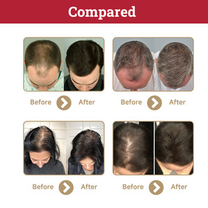 Ventas al por mayor de cabello seco dañado y aceite para el crecimiento, aceite para el cabello de fuerza intensiva, cápsulas nutritivas para reparar el cabello - Product Image 6