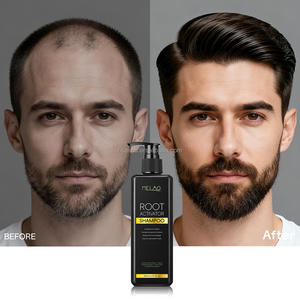 Champú Activador de Raíz de Jengibre y Romero de Marca Privada, Champú Orgánico Anticaída del Cabello, Cuidado del Cuero Cabelludo con Biotina, Champú Natural para el Crecimiento del Cabello - Product Image 1