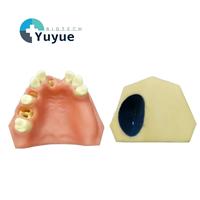 Modelo K de Implante Dental para Seno Maxilar y Dientes Faltantes - Herramienta de Entrenamiento Dental para Levantamiento de Seno y Práctica de Implantes