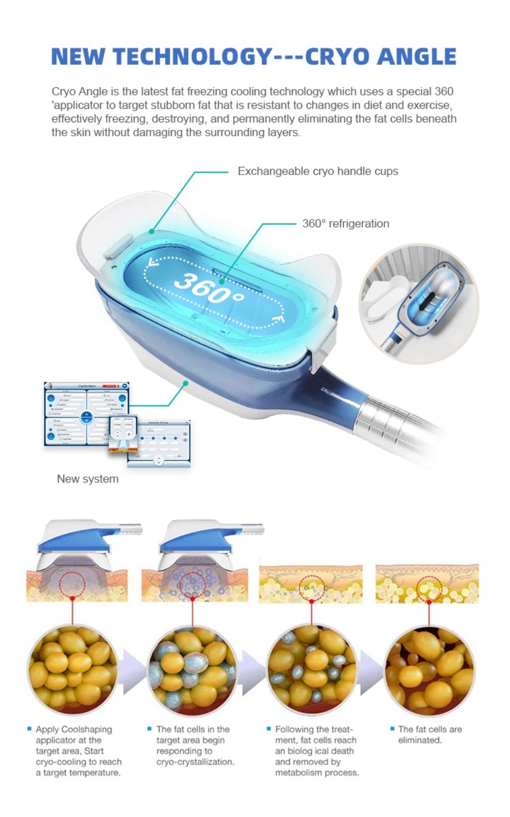 Top Trending Products 2022 360 Cryolipolyse Cryotherapy Machine / Criolipolisis Machine Cryolipolysis