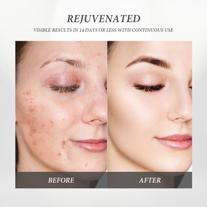 Wholesale Pure Rose Water Natural Face Toner for Oily Skin Care Private Label Whitening Factory Prices Rose Water Toner - Product Image 4