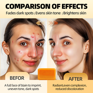 Tự Nhiên Hữu Cơ Nghệ Xà Phòng Thanh Làm Bằng Tay Làm Trắng Da Và Giữ Ẩm Tắm Mặt Chăm Sóc Cơ Thể Chống Lão Hóa Nhà Máy Trực Tiếp - Product Image 3