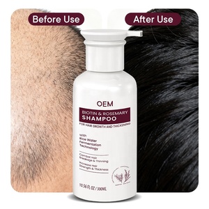 Estratti naturali Cruelty-Free migliorare la <span class=keywords><strong>crescita</strong></span> dei <span class=keywords><strong>capelli</strong></span> attivare follicoli piliferi biotina & rosmarino <span class=keywords><strong>Shampoo</strong></span> per la <span class=keywords><strong>crescita</strong></span> dei <span class=keywords><strong>capelli</strong></span> e ispessimento - Product Image 5