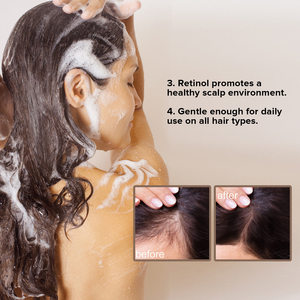 Champú Sólido Vegano de <span class=keywords><strong>Agua</strong></span> de Arroz al por Mayor, 100g, Nutritivo, Hidratante, Anti-Frizz, Jabón Artesanal para el Cuidado del Cabello <span class=keywords><strong>y</strong></span> la Piel - Product Image 5