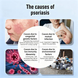 Plantenextract Antibacteriële Tinea-zalf Krachtige bacteriedodende verzachtende reparatie van hardnekkige Tinea voor de huidverzorging van handen, voeten en lichaam - Product Image 2