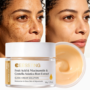 Crème Hydratante Éclaircissante Anti-Taches et Anti-Imperfections pour le Visage – Soin Complet Anti-Acné et Anti-Imperfections pour une Peau Unifiée et Lumineuse - Product Image 1
