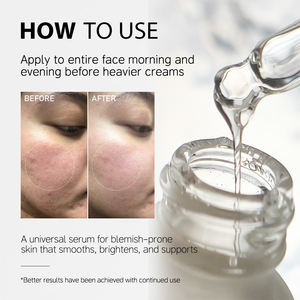 10% + цинковый 1% раствор KOEC, натуральная Сыворотка для лица, ха, кофеин, ага, салициловая кислота, ретинол, раствор, оптовая продажа - Product Image 4