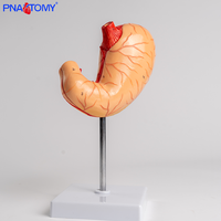 Modelo de estómago de tamaño natural Simulación Mucosa gástrica Sistema vascular Desmontaje para ciencia médica Órgano del sistema digestivo