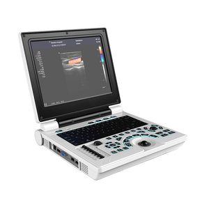 Échographe Doppler Couleur Portable pour Hôpital, Appareil d'Échographie à <span class=keywords><strong>Prix</strong></span> Abordable, Échographe Vétérinaire - Product Image 2