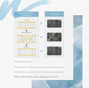 Großhandel Elektro po ration <span class=keywords><strong>Beauty</strong></span> <span class=keywords><strong>Device</strong></span> Poren schrumpfen Hoch durchlässigkeit stech no logie Hauts traffungs maschine - Product Image 5
