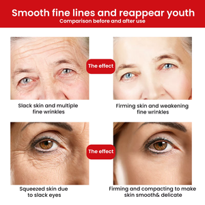 Nhãn Hiệu Riêng Không Có Tiêm Loại Bỏ Nếp Nhăn Nâng Trẻ Hóa Sửa Chữa Nhau Thai Cừu Huyết Thanh Protein Trên Khuôn Mặt Huyết Thanh Chất Kit - Product Image 6