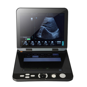Appareils <span class=keywords><strong>d</strong></span>'échographie médicale, <span class=keywords><strong>prix</strong></span> de l'<span class=keywords><strong>appareil</strong></span> <span class=keywords><strong>d</strong></span>'échographie noir et blanc, <span class=keywords><strong>scanner</strong></span> vétérinaire portable - Product Image 3