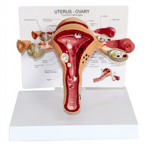 Modelo de Entrenamiento de Patología Médica: Maniquí de Agrandamiento Uterino de PVC de Tamaño Real Avanzado para Uso en Escuelas de Medicina y Hospitales - Product Image 1