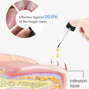 Tratamiento para Hongos en las Uñas, Reparación y Fortalecimiento de los Pies, Esencia Reparadora de Hongos en las Uñas, Suero para el Tratamiento de las Uñas - Product Image 3