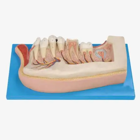 Modello di denti per bambini, modello dentale di anatomia, mascella inferiore di 12 anni