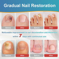 Vente en gros d'usine SAMVO 72 pièces de soin des ongles, gel antifongique, autocollant de correction de renouvellement, patch auto-adhésif, traitement rapide des ongles fongiques