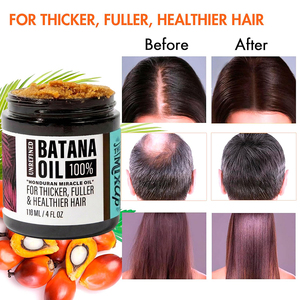 Huile de Batana Hondurienne Miracle 100 % Pure, Naturelle et Biologique : Réduit la Casse, Stimule la Croissance des Cheveux - Product Image 6