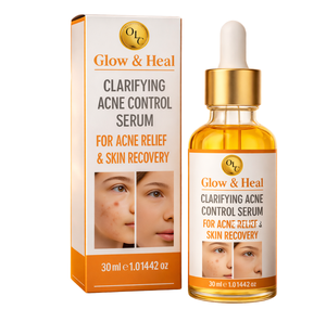 Sérum Visage Anti-Acné Clarifiant et Réparateur 30ml – Soulagement Efficace de l'Acné – Meilleure Vente - Product Image 1
