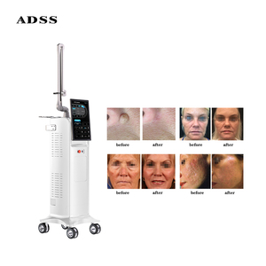 Machine à <span class=keywords><strong>laser</strong></span> fractionné CO2 de <span class=keywords><strong>chirurgie</strong></span> professionnelle ADSS Big Power 60W pour l'élimination des cicatrices et le rajeunissement de la peau - Product Image 2