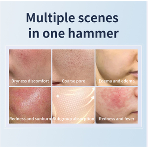 Gesichts-Eisfleck-Massagegerät, Handgehaltene Schönheitsmaschine mit Hautkühlung & Kältetherapie-Hammer - US & CN Kompatibel - Product Image 5