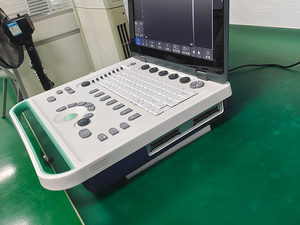Appareil à ultrasons portable LCD de 15 pouces Dispositif à ultrasons transrectal micro-convexe Dispositif à ultrasons Diagnostic à distance - Product Image 6
