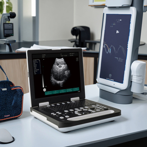 Đầy đủ kỹ thuật số máy tính xách tay máy quét siêu âm SS-10 - Product Image 5