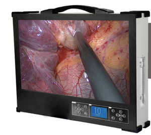 Caméra vidéo de diagnostic médical tout-en-un à bas prix Caméra d'endoscopie pour oreilles, nez et gorge et laparoscopie - Product Image 4