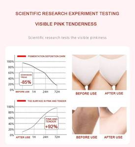 Produits pour adultes Soins féminins Gel d'hygiène intime blanchissant et éclaircissant naturel Crème à l'essence rose noire et blanchissante - Product Image 6