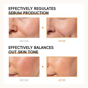 Tónico Facial LAIKOU 100ml con Leche de Arroz y Hamamelis, Hidratante y Refrescante para una Piel Saludable - Product Image 6