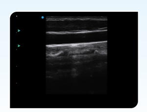 SIUI CTS-6600 <span class=keywords><strong>Ultrasound</strong></span> dokter hewan kualitas tinggi pabrik genggam B/W mesin <span class=keywords><strong>Ultrasound</strong></span> dokter hewan - Product Image 6