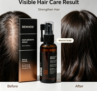 Huile de croissance capillaire à la caféine, biotine et peptides, bloqueur naturel du DHT, traitement anti-chute de cheveux, cheveux clairsemés, ligne de cheveux reculée, 2-en-1