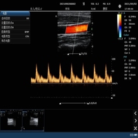 Sistema de Ultrasonido Doppler Color, Equipo de Diagnóstico Médico, Monitor HD de 15 Pulgadas, Modo B, Modo M, Máquina de Imágenes Doppler Color PW