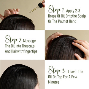 Proveedor al por Mayor de Aceite de Batana, Gotas Líquidas Desintoxicantes para el Cuero Cabelludo con Romero, 60 ml, Cosmético para Adultos, Servicio OEM, Apoyo Inmunológico, Empaque Personalizado - Product Image 2