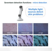 Détecteur de peau multifonctionnel, analyseur facial intelligent AI