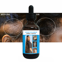 Sérum de Croissance Capillaire Traitement Anti-Chute Cuir Chevelu Fortifiant Cheveux Plus Épais et Plus Longs Repousse Rapide à Base de Plantes HUILE CAPILLAIRE HERBALE