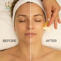 Masque facial en feuille d'or pur 24 carats 4,33*4,33 cm pour le soin du visage et l'éclaircissement de la peau - Vente flash