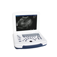 Dawei Portable Bw Machine à ultrasons Ordinateur portable Vet Machine à ultrasons Scanner convexe pour cheval