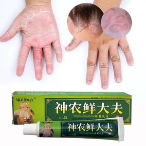 Crema <span class=keywords><strong>de</strong></span> Extracto Herbal Chino Natural <span class=keywords><strong>de</strong></span> Alta Calidad, Ungüento Antibacteriano para Psoriasis y Eccema, Alto en Vitaminas e Ingredientes Activos - Product Image 6