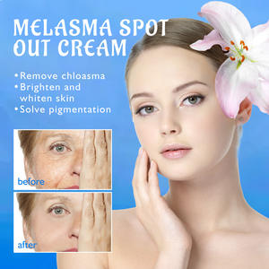 Vente chaude spot éclaircissant crème pour le visage anti-taches mélanine chloasma hydratant hydratant et blanchissant crème pour le visage - Product Image 2