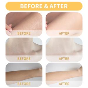 Sérum Corporel Professionnel Hydratant et Éclaircissant au Glutathion Essentiel pour Femmes, Améliore les Cicatrices, Huile de Massage Corporel - Product Image 4