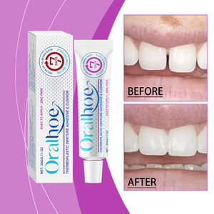 <strong>Denture</strong> <strong>Adhesive</strong>, Thermoplastic Formula, <strong>Secures</strong> <strong>Dentures</strong> and Improves Wearing comfort - Product Image 2