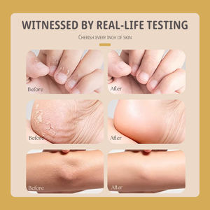 Una crema lenitiva che allevia la pelle secca e screpolata di mani e piedi, e fornisce sollievo dal gonfiore e idratazione - Product Image 5