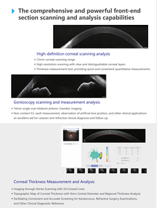 Equipo de Diagnóstico Oftalmológico con Función de Análisis de Campo Amplio, Angiografía, Tomografía de Coherencia Óptica HS-300 - Product Image 6