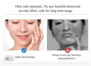 Private label di qualità <span class=keywords><strong>molto</strong></span> buona formula sicura anti cloasma lentiggine melasma macchie scure <span class=keywords><strong>crema</strong></span> sbiancante - Product Image 5