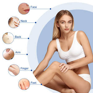 ELAIMEI Portable Large Size <strong>Skin</strong> <strong>Tag</strong> <strong>Removal</strong> Pen Kit Safe and Effective Auto <strong>Skin</strong> <strong>Tag</strong> Remover for Home Use - Product Image 5