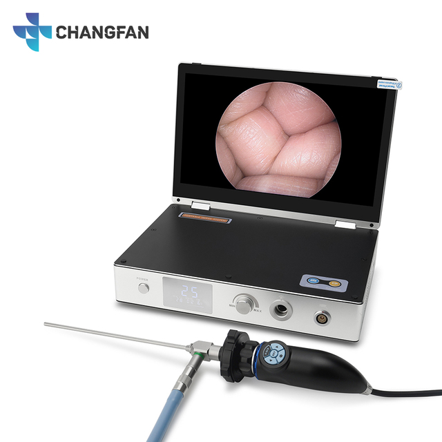 11.6 Inch 4-in-1 Full HD 1080P All-in-One Portable ENT Endoscope Camera System Ear Nose Throat Endoscopy Equipment
